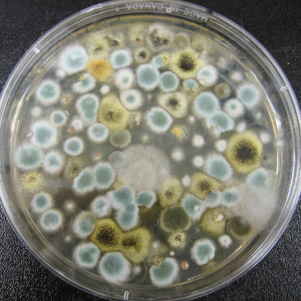 Petri dish of growing bacteria